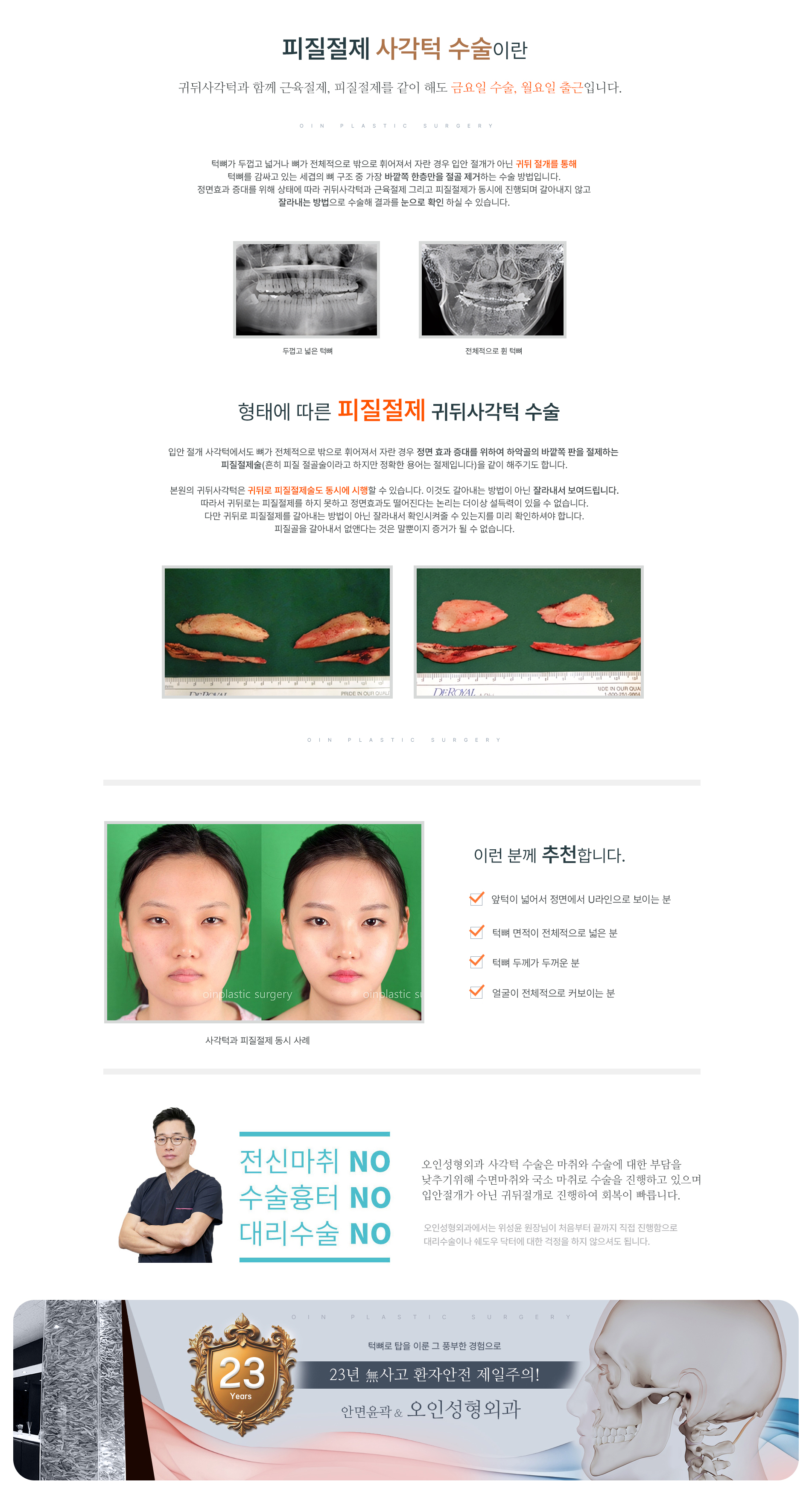 피질절제 귀뒤사각턱수술 > 귀뒤사각턱의 특별한 솔루션 > 귀뒤사각턱(턱뼈탑) > 대한민국 사각턱 NO.1 오인성형외과